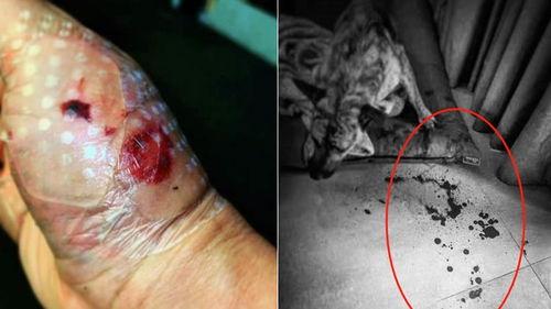 手破皮了 明星,揭秘明星手破皮背后的故事